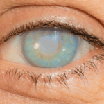 Erblindung, Netzhautablösung, Sehnerventzündung: Sehstörungen nach COVID-19 Shots – Stand der Forschung